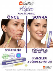 Dr. Algler Acne Clear Gel - Sivilce Karşıtı Kurutucu Jel 10 ml - 2 Günde Etkili %100 Organik Yosun Özlü Bakım